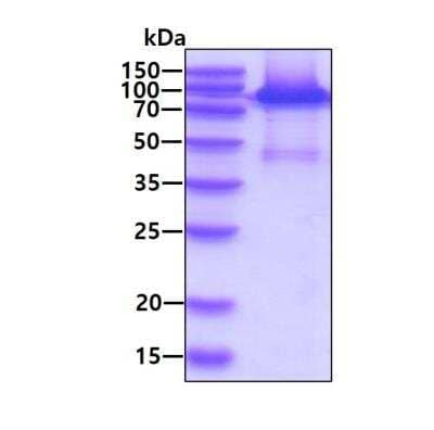 SDS-PAGE: Recombinant Human PRMT1 His-MBP Protein [NBC1-18446]