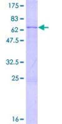 SDS-PAGE: Recombinant Human PRPF8 GST (N-Term) Protein [H00010594-P01]