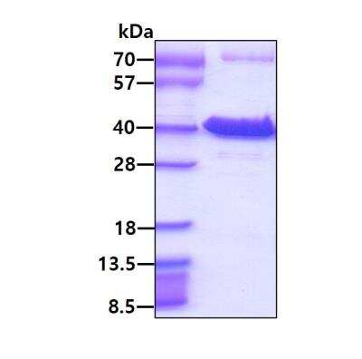 SDS-PAGE: Recombinant Human PRPS1 His Protein [NBP1-37079]