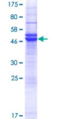 SDS-PAGE: Recombinant Human PRUNE2 GST (N-Term) Protein [H00158471-P01]