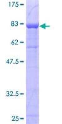 SDS-PAGE: Recombinant Human PSAP GST (N-Term) Protein [H00005660-P02]