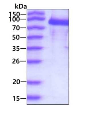 SDS-PAGE: Recombinant Human PSMA/FOLH1/NAALADase I His Protein [NBP3-12866]