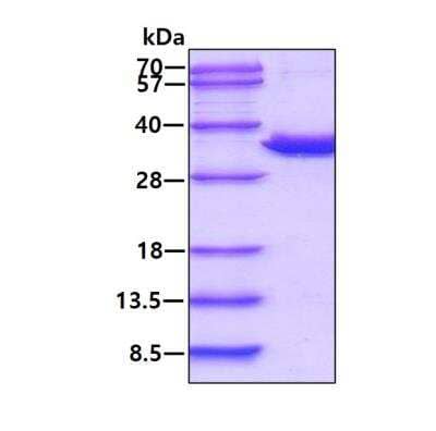 SDS-PAGE: Recombinant Human PSMA1 His Protein [NBP1-72482]