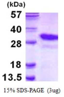 SDS-PAGE: Recombinant Human PSMA8 His Protein [NBP1-78819]