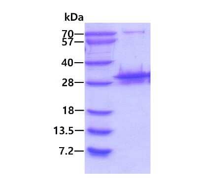 SDS-PAGE: Recombinant Human PSMB10/MECL1 His Protein [NBP1-72454]