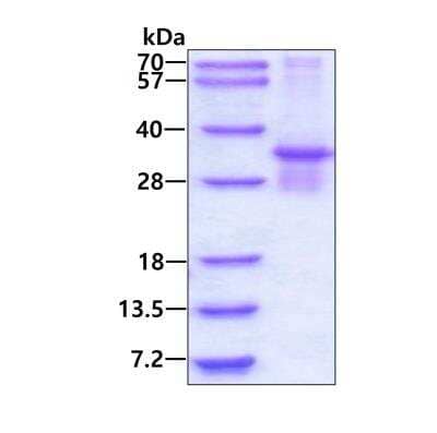 SDS-PAGE: Recombinant Human PSMB7 His Protein [NBP1-99093]