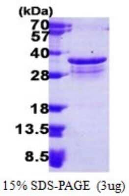 SDS-PAGE: Recombinant Human PSMF1 His Protein [NBP1-78851]