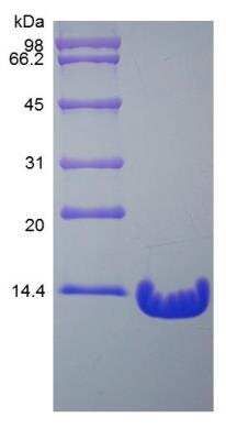 SDS-PAGE: Recombinant Human PTH Protein [NBP2-76813]