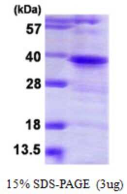 SDS-PAGE: Recombinant Human PTK9 His Protein [NBP1-78821]