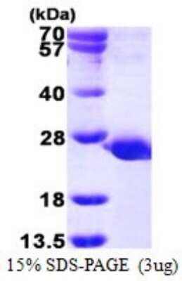 SDS-PAGE: Recombinant Human PTPMT1 His Protein [NBP1-78852]