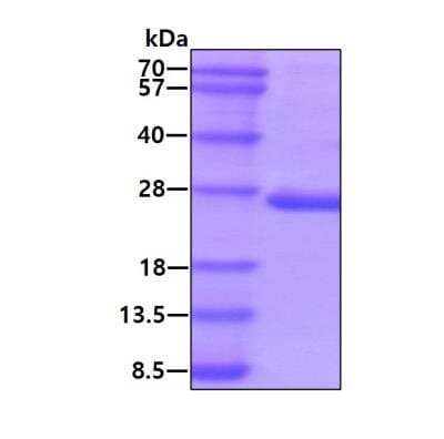 SDS-PAGE: Recombinant Human PTPMT1 His Protein [NBP1-78852]