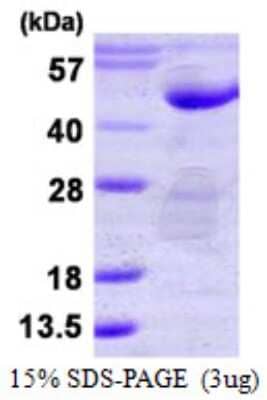 SDS-PAGE: Recombinant Human PTPN7 His Protein [NBP1-99068]