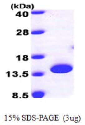 SDS-PAGE: Recombinant Human PTRH2 His Protein [NBP1-50914]