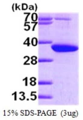 SDS-PAGE: Recombinant Human PYCR1 His Protein [NBP1-50895]