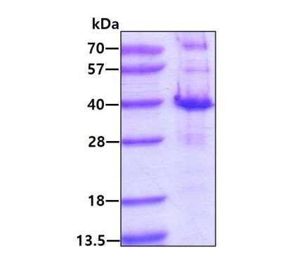 SDS-PAGE: Recombinant Human PYCR2 His Protein [NBP2-52069]