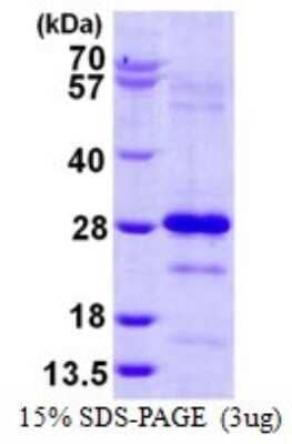 SDS-PAGE: Recombinant Human Pallidin His Protein [NBP1-99052]