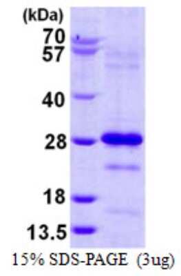 SDS-PAGE: Recombinant Human Pallidin His Protein [NBP1-99052]