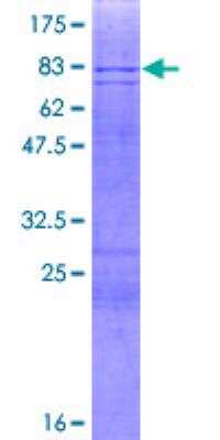 SDS-PAGE: Recombinant Human Pancreatic Amylase Beta GST (N-Term) Protein [H00000280-P02]