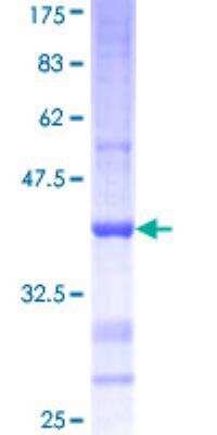 SDS-PAGE: Recombinant Human Pancreatic Amylase Beta GST (N-Term) Protein [H00000280-Q01]