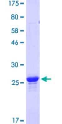 SDS-PAGE: Recombinant Human Paxillin GST (N-Term) Protein [H00005829-P03]