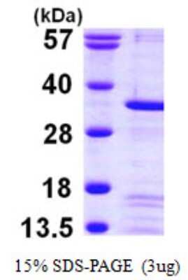 SDS-PAGE: Recombinant Human Peflin His Protein [NBP1-50984]