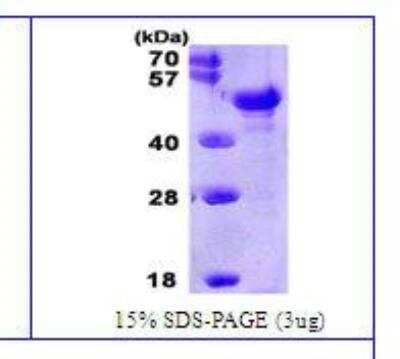 SDS-PAGE: Recombinant Human Pentraxin 3/TSG-14 His Protein [NBC1-26376]