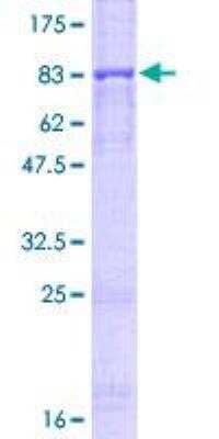 SDS-PAGE: Recombinant Human Perforin GST (N-Term) Protein [H00005551-P01]