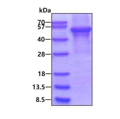 SDS-PAGE: Recombinant Human Perilipin-2/ADFP T7 Protein [NBP2-53039]