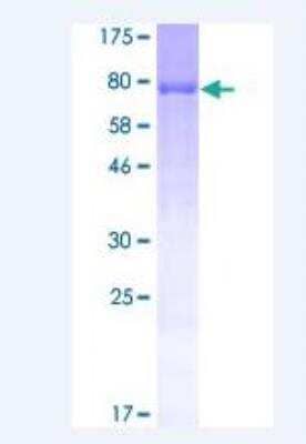 SDS-PAGE: Recombinant Human Peripherin GST (N-Term) Protein [H00005630-P01]