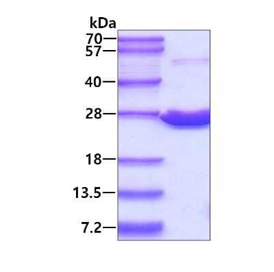 SDS-PAGE: Recombinant Human Peroxiredoxin 1 His Protein [NBC1-18543]