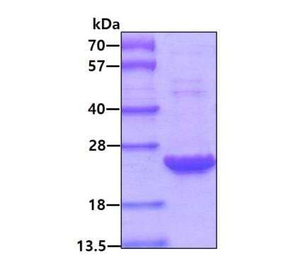 SDS-PAGE: Recombinant Human Peroxiredoxin 2 Protein [NBC1-25855]