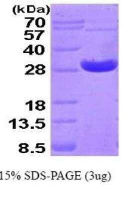 SDS-PAGE: Recombinant Human Peroxiredoxin 4 His Protein [NBP1-41141]