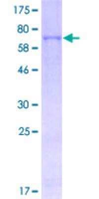 SDS-PAGE: Recombinant Human Phenylalanine Hydroxylase GST (N-Term) Protein [H00005053-P01]