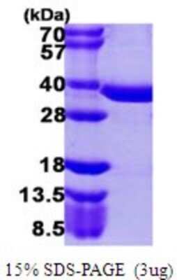 SDS-PAGE: Recombinant Human Phosphopantothenate-cysteine ligase His Protein [NBP1-78806]