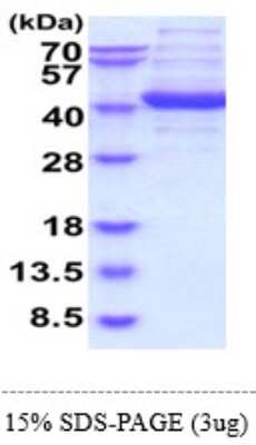 SDS-PAGE: Recombinant Human Aldolase C Protein [NBP2-61209]