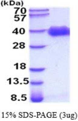 SDS-PAGE: Recombinant Human Pref-1/DLK1/FA1 His Protein [NBP2-52245]