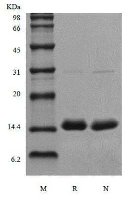 SDS-PAGE: Recombinant Human Procalcitonin Protein [NBP2-61448]