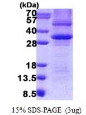 SDS-PAGE: Recombinant Human Prohibitin His Protein [NBP2-23364]