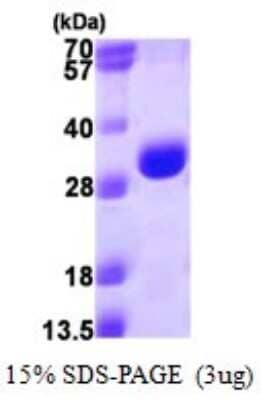 SDS-PAGE: Recombinant Human Proteasome 20S alpha 3 His Protein [NBP1-72526]