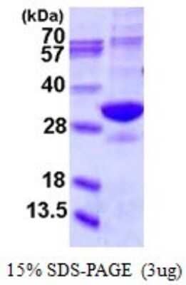 SDS-PAGE: Recombinant Human Proteasome 20S alpha 5 His Protein [NBP1-78835]