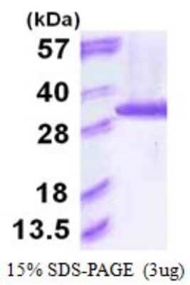 SDS-PAGE: Recombinant Human Proteasome 20S alpha 6 His Protein [NBP1-72546]