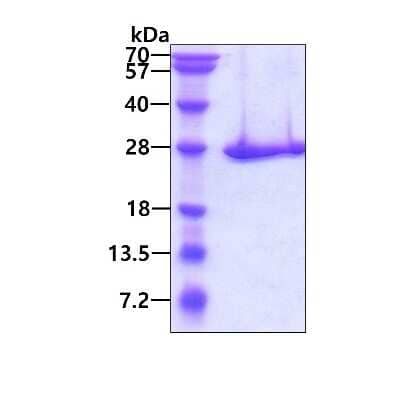 SDS-PAGE: Recombinant Human Proteasome 20S beta 3 His Protein [NBP1-72544]