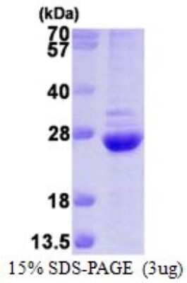 SDS-PAGE: Recombinant Human Proteasome 20S beta 6 His Protein [NBP1-78850]