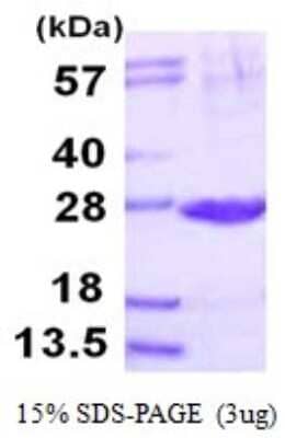 SDS-PAGE: Recombinant Human Proteasome 20S beta2 His Protein [NBP1-78820]