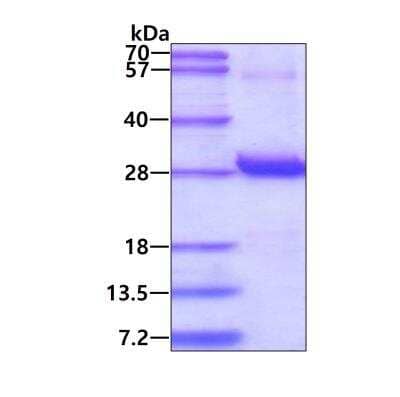 SDS-PAGE: Recombinant Human Proteasome beta 1 His Protein [NBP1-37087]