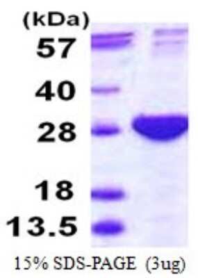 SDS-PAGE: Recombinant Human Proteasome subunit beta type 4 His Protein [NBP1-72545]