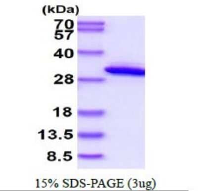 SDS-PAGE: Recombinant Human QDPR His Protein [NBP1-72416]