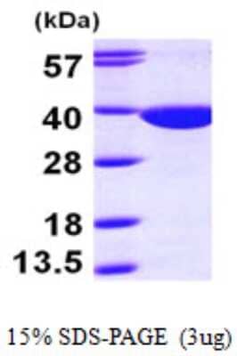 SDS-PAGE: Recombinant Human QPRT His Protein [NBP1-48363]