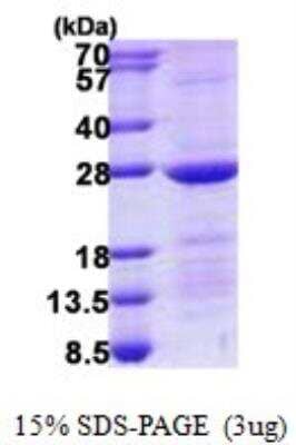 SDS-PAGE: Recombinant Human RAB10 His Protein [NBP2-23392]