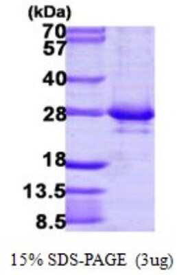 SDS-PAGE: Recombinant Human RAB14 His Protein [NBP1-72353]